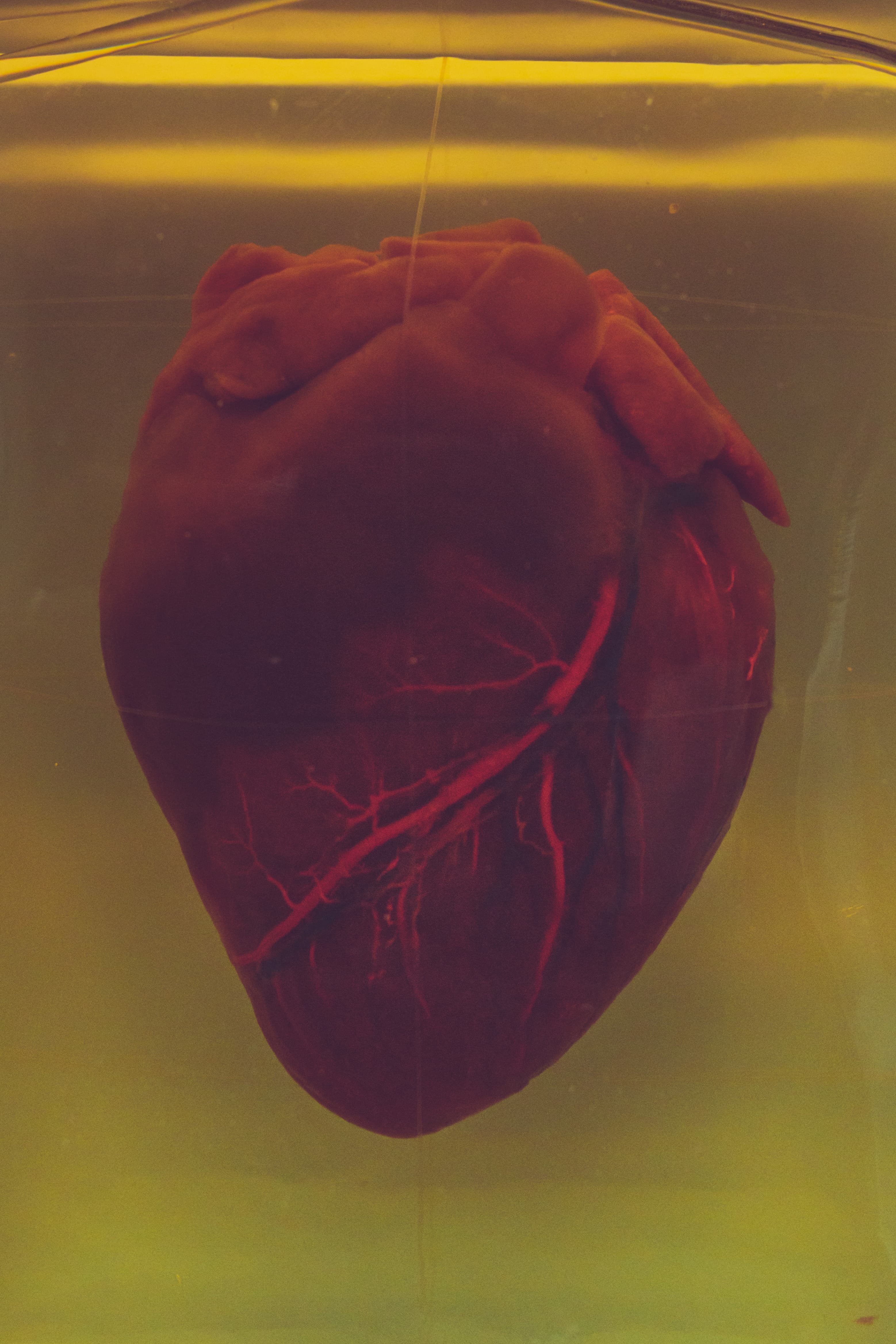 L’AMOUR A CONTRE SENS
