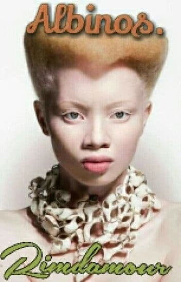 Albinos